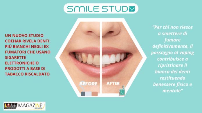 denti smile study